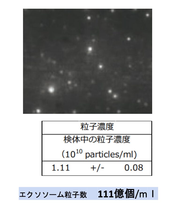 セルヴィーナエクソソーム